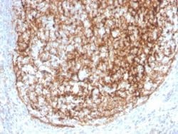 CD35 Antibody (CR1/4382R) - Azide and BSA Free, Novus Biologicals 100 &mu;g | Buy Online | Novus Biologicals | Fisher Scientific